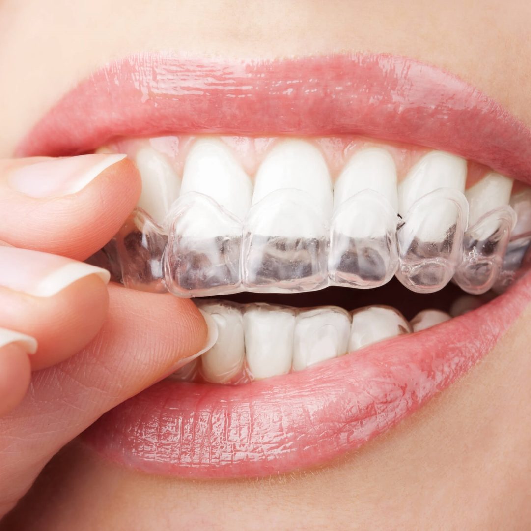 Planos Odontológicos